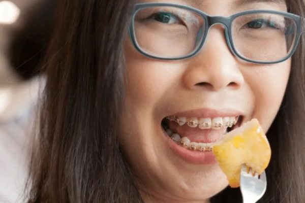 Bí quyết tăng cân cho người niềng răng​