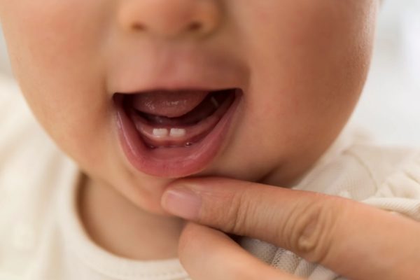 Hiểu đầy đủ về quá trình mọc răng ở trẻ Hiểu đầy đủ về quá trình mọc răng ở trẻ